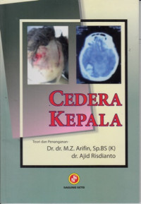 Cedera Kepala